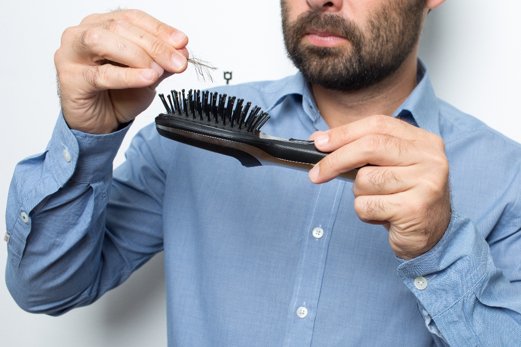 man losing hair